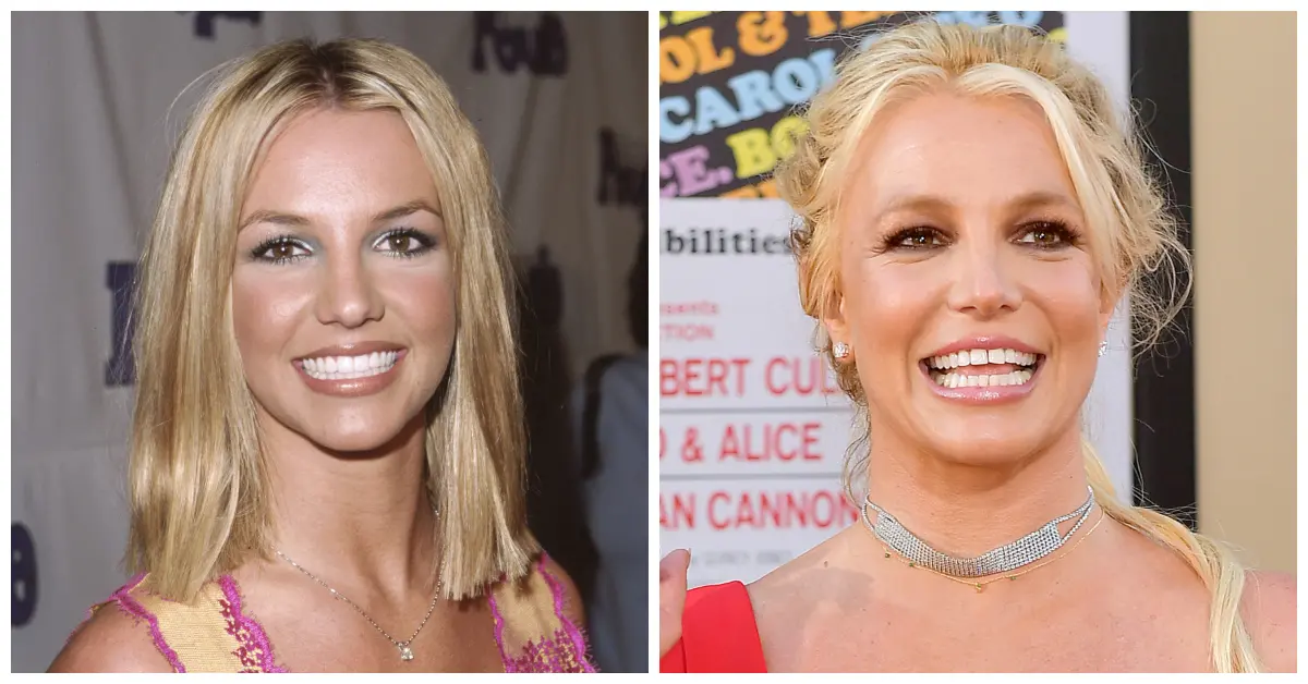 Britney Spears before dental work
